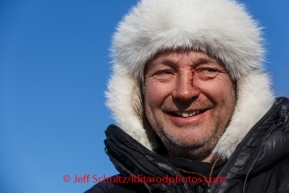 Ralph Johannessen shows the signs of a crash on his nose at Ruby on Friday, March 7, during the Iditarod Sled Dog Race 2014.PHOTO (c) BY JEFF SCHULTZ/IditarodPhotos.com -- REPRODUCTION PROHIBITED WITHOUT PERMISSION